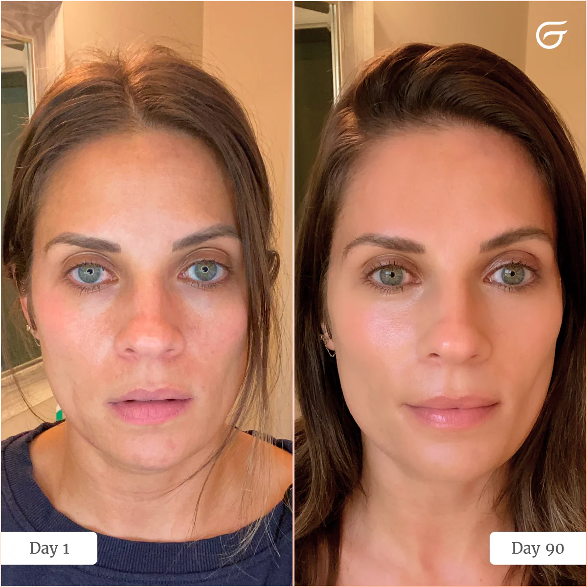 GlowUp™ LED Light Therapy Neck & Chest Mask - Image 5